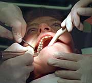 Patientin mit Amalgam-F�llungen